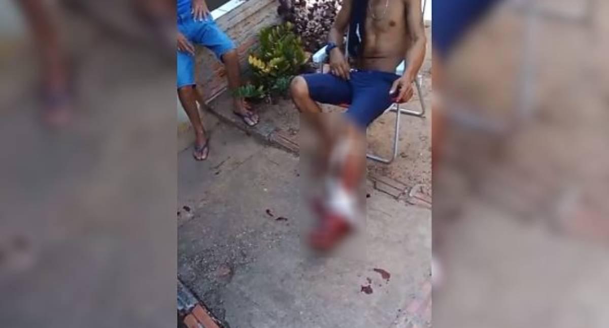 Homem é baleado na perna durante ataque a tiros em residência em RO