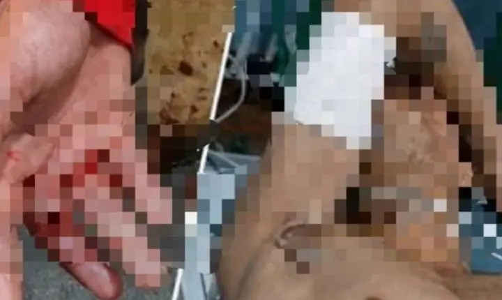 Tentativa de homicídio deixa um morto e um ferido em RO